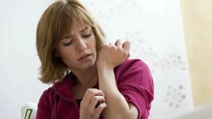 ქავილის მიზეზი