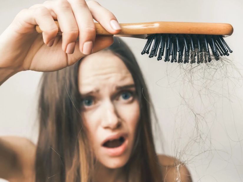 თმის ცვენა